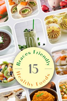 15 braces friendly healthy foods