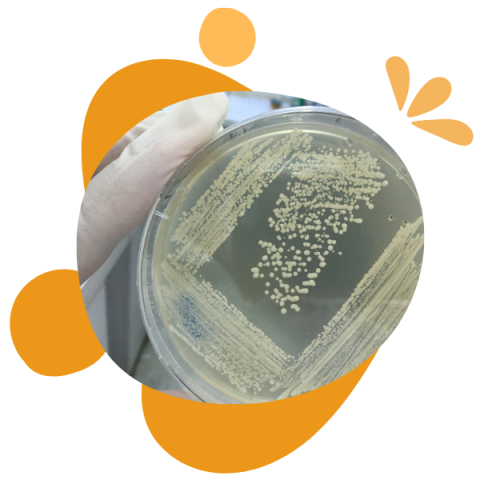 Probióticos contra Helicobacter pylori